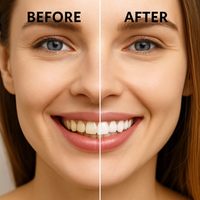 Radiant Smile Whitening Pen™